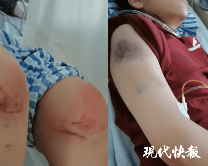 石家庄被家暴女子驾车逃跑致丈夫身亡，一审以故意杀人罪获刑11年