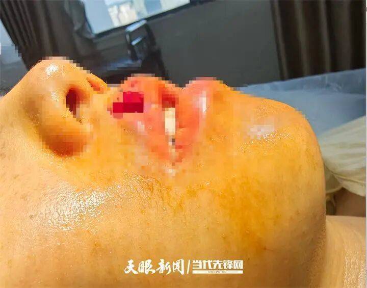 女子上门代喂,被100多斤阿拉斯加犬咬伤遭毁容,狗主人称不担全责